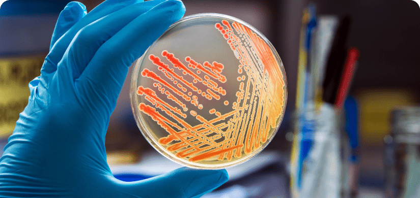 Nitrile Gloved hand holding culture smear on petri dish.