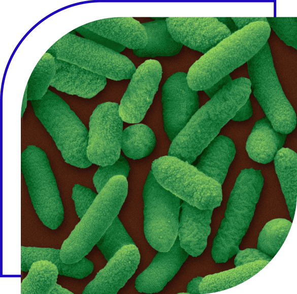 Combating Cronobacter in Foods: Causes, Concerns and Solutions